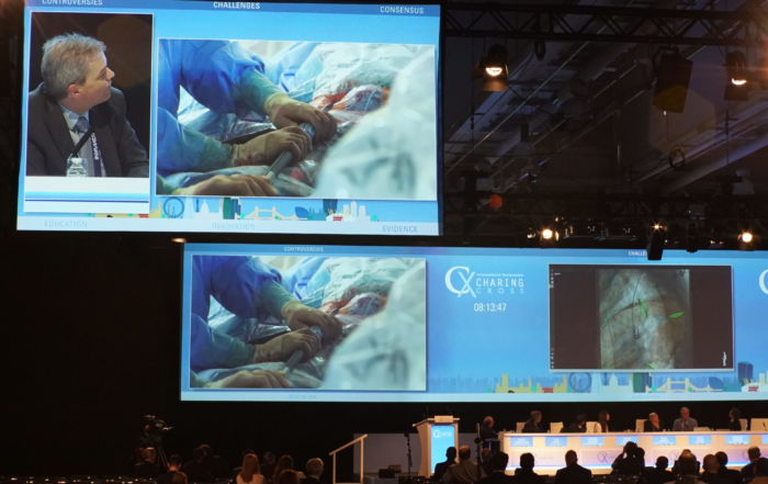 TEVAR virtual reality at CX2019